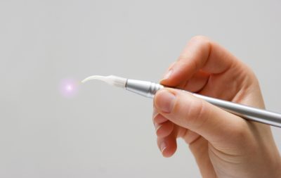 featured image for laser treatment