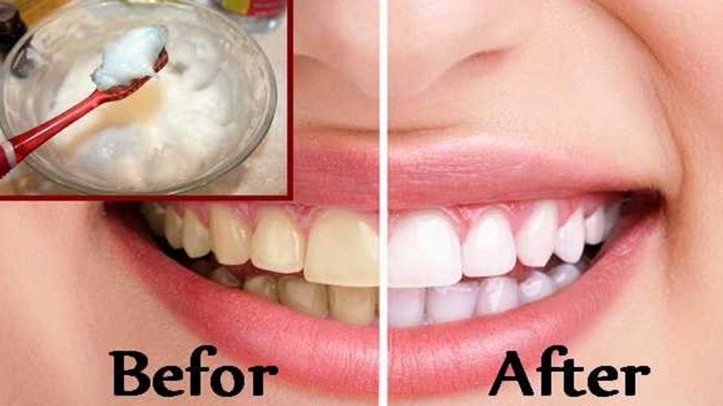 image for affordable dental