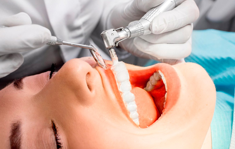 image for teeth cleaning procedure