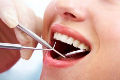 featured image for price of teeth cleaning in the philippines