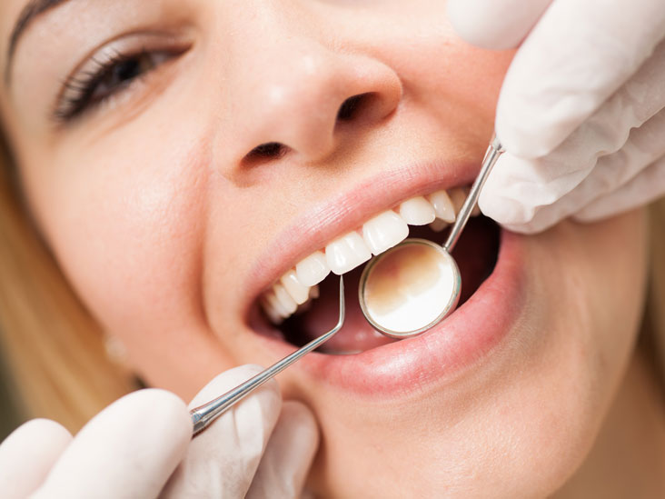 image for price of teeth cleaning in the philippines