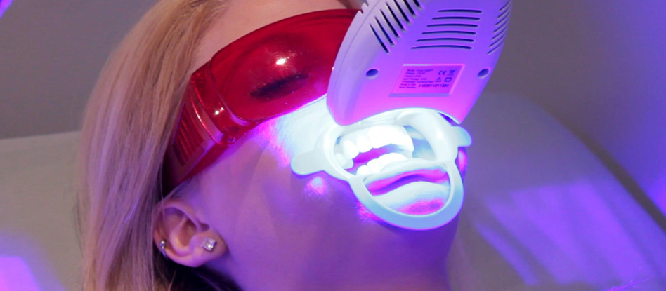 image for laser teeth whitening procedure
