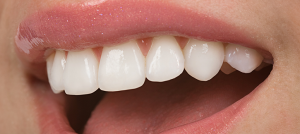 featured image for cosmetic dentistry