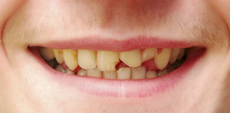 image for manila dentist