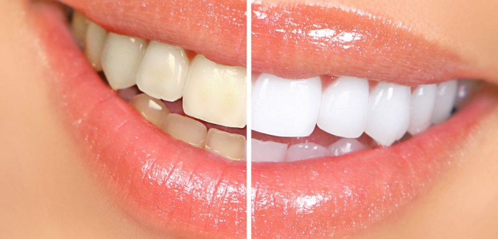 image for cosmetic dentistry
