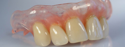 featured image for flexible dentures