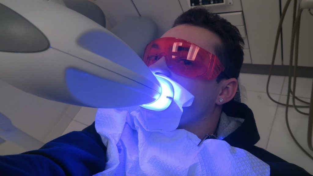 image for laser in teeth whitening