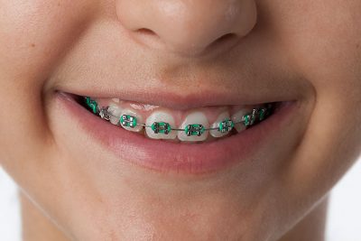 image for Orthodontist in Manila