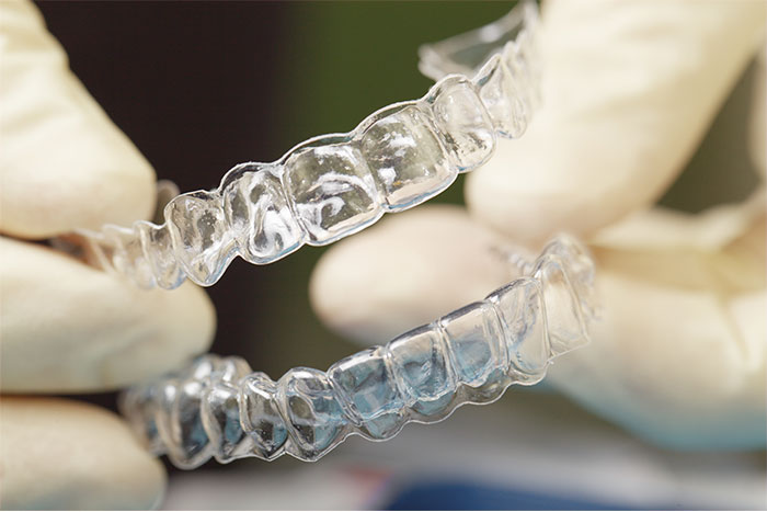 image for Are retainers good for your teeth