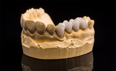 image for price of false teeth in the Philippines