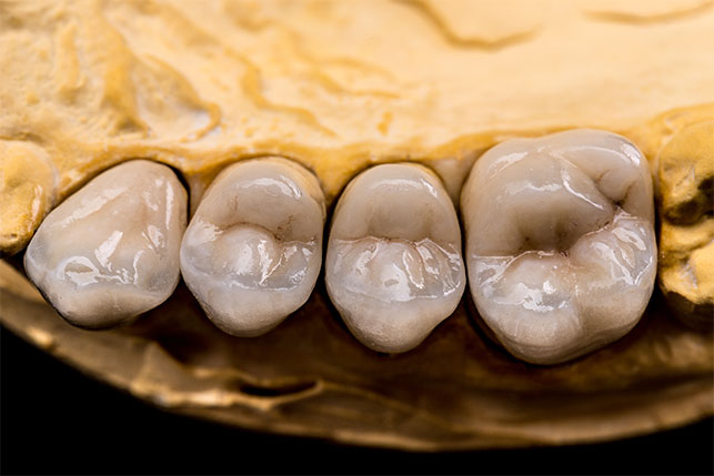 image for price of false teeth in the Philippines