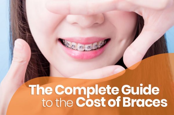 The Complete Guide to the Cost of Braces | Blog | Asian Sun Dental