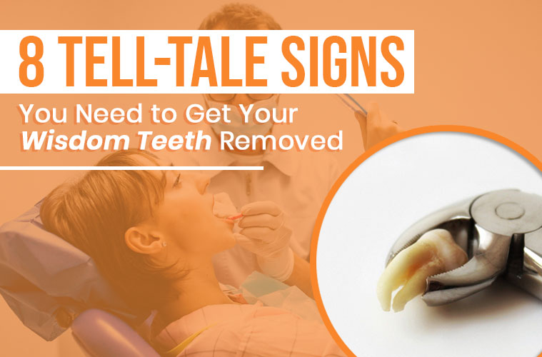 8 Tell-Tale Signs You Need to Get Your Wisdom Teeth Removed