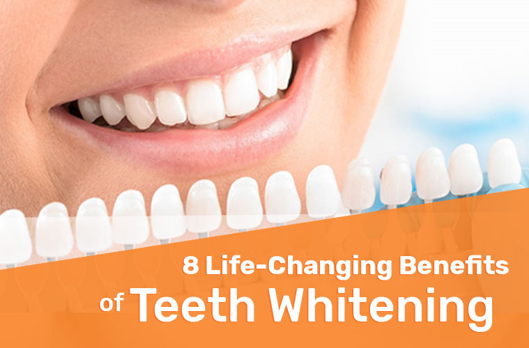 8 Life-Changing Benefits of Teeth Whitening